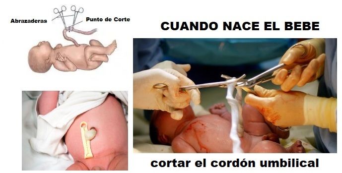 como cortar el cordon umbilical