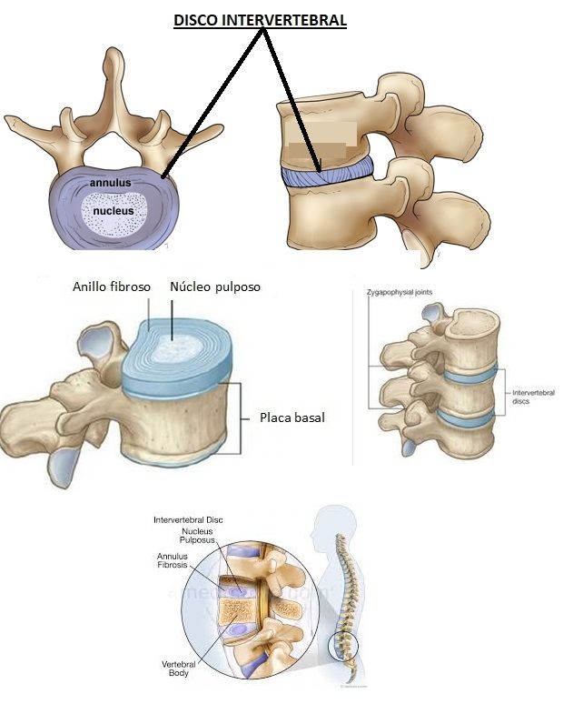 disco intervertebral