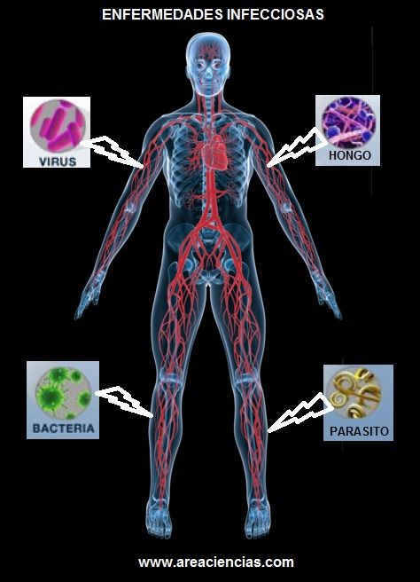 enfermedades infecciosas