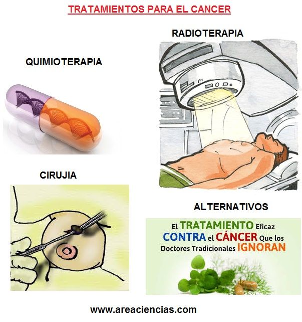 tratamientos cancer