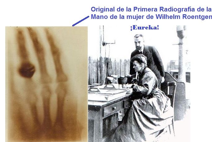 primera radiografia