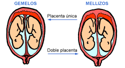 gemelos y mellizos