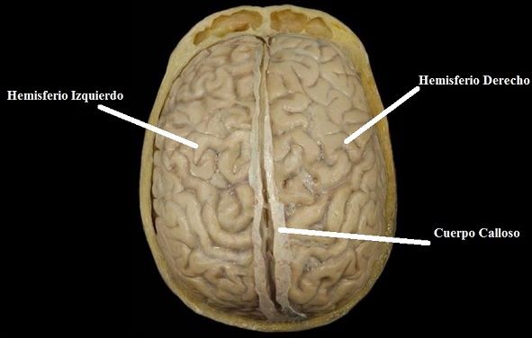 hemisferios cerebrales