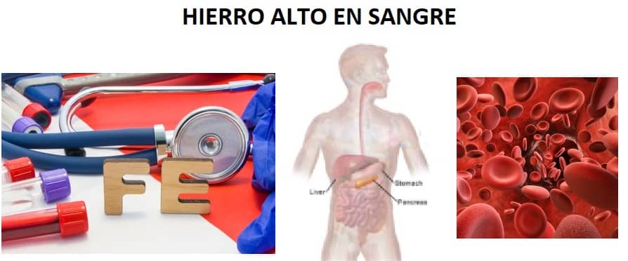 hierro alto